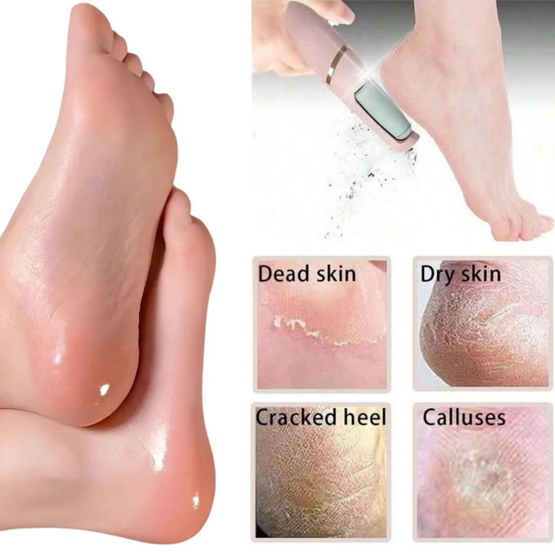 Electric Foot Callus Remover