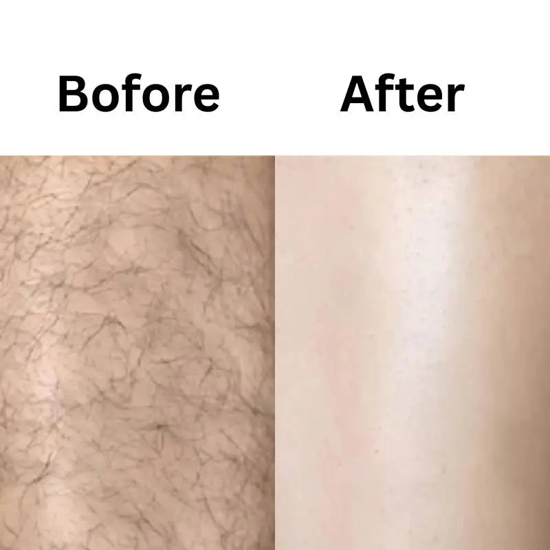 Eelhoe Hair Removal Spray for Women | بشرة ناعمة وحريرية