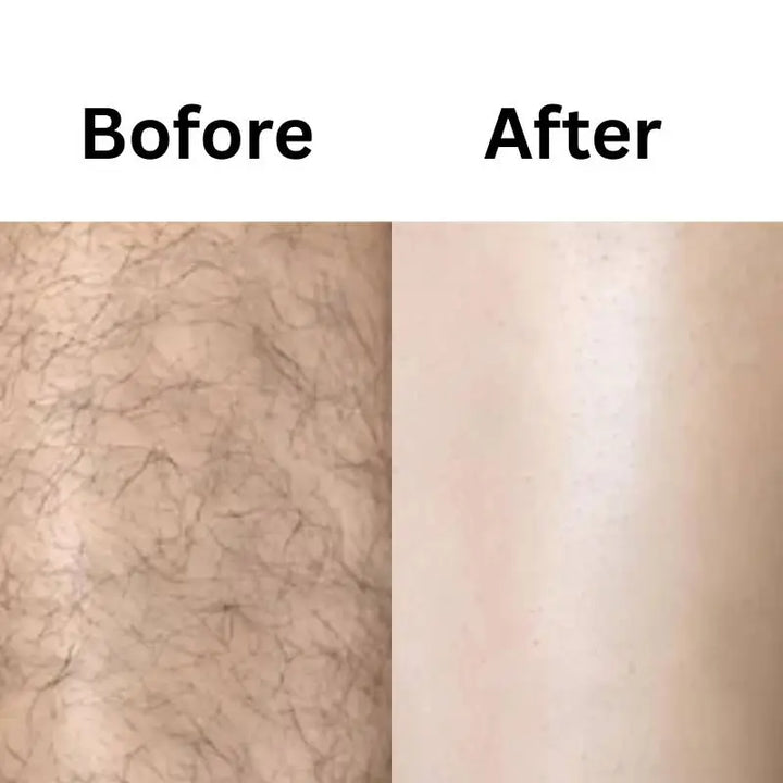 Eelhoe Hair Removal Spray for Women | بشرة ناعمة وحريرية